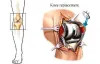 Total knee replacement surgery hospital in Delhi