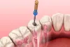 Clínica Dental en España | Expertos en Salud Oral