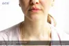 How to Treat Chapped Lips