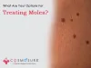 Mole Removal Treatment In Hyderabad | Cosmosure Clinic