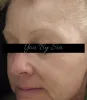Cure Dry Skin - Moisture LED Facial Treatment | You By Sia