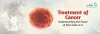 Understanding the Power of Stem Cells in Treating Cancer