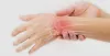 Know About the Treatment of Sports-Related Hand Injuries | Siiora