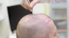 Hair Treatment 