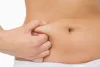Tummy Tuck Treatment 