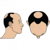 Best Hair Transplant Surgeon in South Delhi