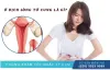 Ứ dịch lòng tử cung nên ăn gì và kiêng gì là tốt nhất