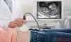   	Ultrasound Near Me by Lady Doctor in Gurgaon | MDRC India  