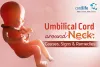 Why Does The Baby Wrap The Umbilical Cord Around The Neck?