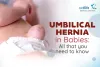 Umbilical Hernia In Babies: All That You Need To Know - Cordlife India