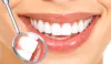 Periodontitis: Symptoms, Causes, Prevention and More - Write on Wall "Global Community of writers"