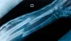 Orthopedic surgeon in Lahore