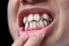 Top Cosmetic Dentistry Options to Fix Misaligned Teeth