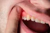 Gum Disease and Overall Health: Prevention Tips