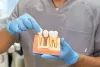 Why Does Chewing Hurt My Dental Implant? Causes &amp; Solutions