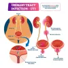 Ayurvedic Treatment for UTI (Urinary Tract Infection) – Kidney and Ayurveda