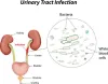 Is Ayurvedic Treatment For Urinary Tract Infection Effective?