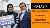 HD-LASIK Surgery
