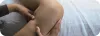 What are the best Spider and Varicose Vein Treatment Options? | A guide by our Harvard Trained Vein Doctors