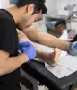 Spider Vein Removal: How To Find The Suitable Treatment. – veincentersli