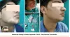 Best Vitiligo Treatment in Delhi, Rohini, Pitampura - Dr Ashok Tandon