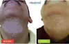 #1 Best Vitiligo Treatment in Durgapur