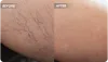 Harvard Trained Vein Doctors | Sclerotherapy Treatment for Spider and Varicose Veins | Spider and Varicose Vein Treatment Center