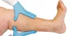 veincentertexas [licensed for non-commercial use only] / what do you Expect at Your Appointment with a Vein Specialist City Centre