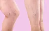 Home - veintreatmentclinic - 7 Tips for Choosing a Vein Specialist In Your City