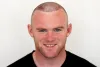 Top 5 Celebrities Who Have Had Hair Transplants - Today News Spot