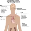 Dr. Siri Kamath | Hypertension Treatment in Bangalore