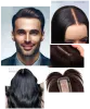 Top Hair Fixing Services | Hair Replacement | Hair wigs shop