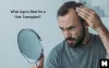 What Age Is Best For A Hair Transplant? - Healthgree