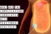 What are The Complications Correlated with Peritoneal Dialysis?
