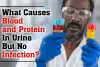 What Causes Blood and Protein in Urine But no Infection?