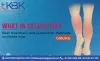 What is Cellulitis? Best Cellulitis treatment and prevention care