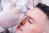 Botox for Migraines: Understanding This Revolutionary Solution