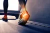 What Are the Plantar Fasciitis Causes and Treatment?