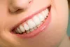 A Complete Guide To A Root Canal Treatment, Procedure, Causes, Cost