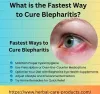 What is the Fastest Way to Cure Blepharitis? - Natural Health News