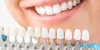 What Patients Need to Know about Dental Implants