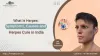 What Is Herpes: Symptoms, Causes and Herpes cure in India