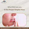 What well are you in the herpes simplex virus?