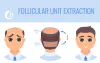 What Is An FUE Hair Transplant