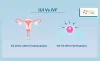 What’s The Difference Between IUI And IVF?