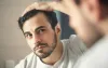 Where do I get the Best Hair Transplantation Procedure from Pakistan? - Health Vital