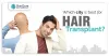 Which City Is The Best For Hair Transplant?