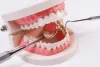 What is Sedation Dentistry &amp; How It Helpful for You – Impact Dental Care