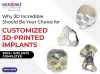 Why 3D Incredible Should Be Your Choice for Customized 3D-Printed Implants | 3DIncredible
