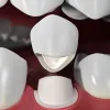 Why Dental Crown Necessary After Root Canal? | El Paso